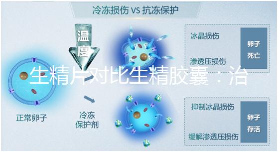 生精片對(duì)比生精膠囊：治療少精弱精，你得這么選！