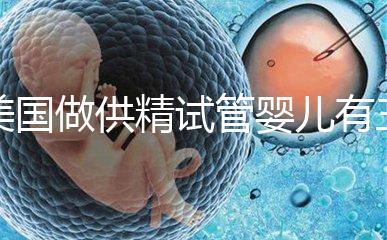 美國做供精試管嬰兒有三大條件，想知道需不需要結婚證戳