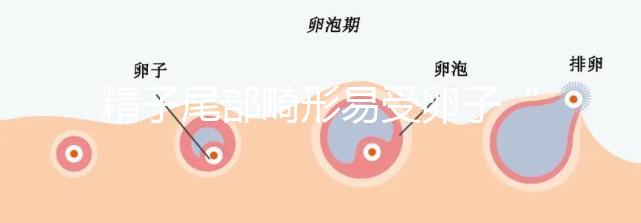 精子尾部畸形易受卵子“嫌棄”，無尾、短卷尾需重視