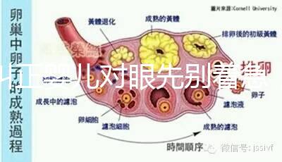糾正嬰兒對(duì)眼先別著急,眼科醫(yī)生教你3招鑒別法