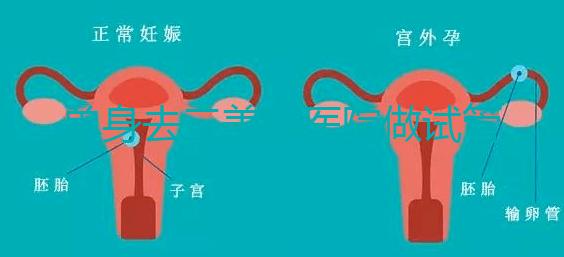 單身去三美泰醫院做試管需要花費多少錢？費用明細是怎么樣的