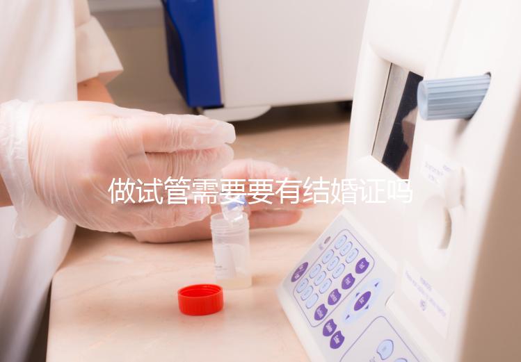做試管需要要有結(jié)婚證嗎？