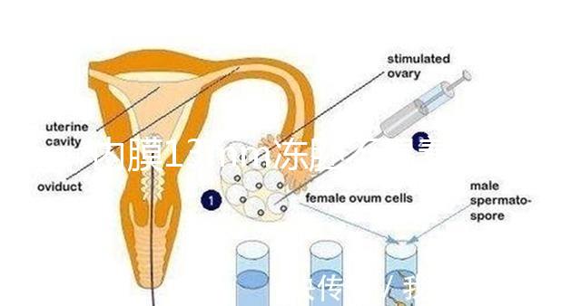 內膜13mm凍胚不易著床要注意，移植與否看醫生怎么說