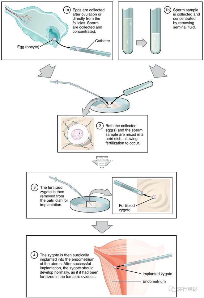國內(nèi)首起試管嬰兒案例,法律竟難以給患者維權(quán)