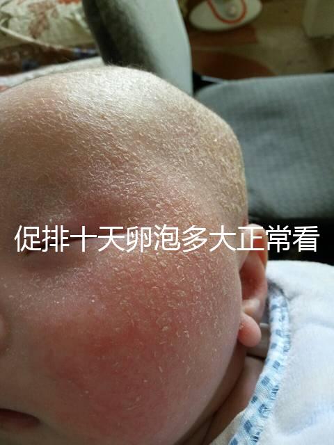 促排十天卵泡多大正?？催@，1.1×0.9符不符合一文說清