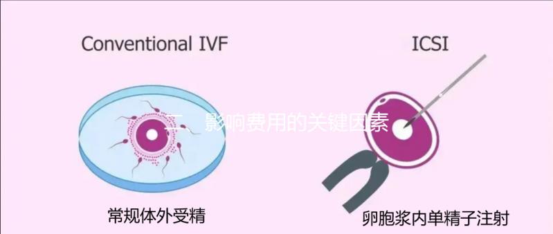 二、影響費用的關(guān)鍵因素