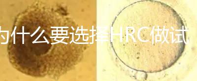 為什么要選擇HRC做試管？這6大優勢看完就知道答案