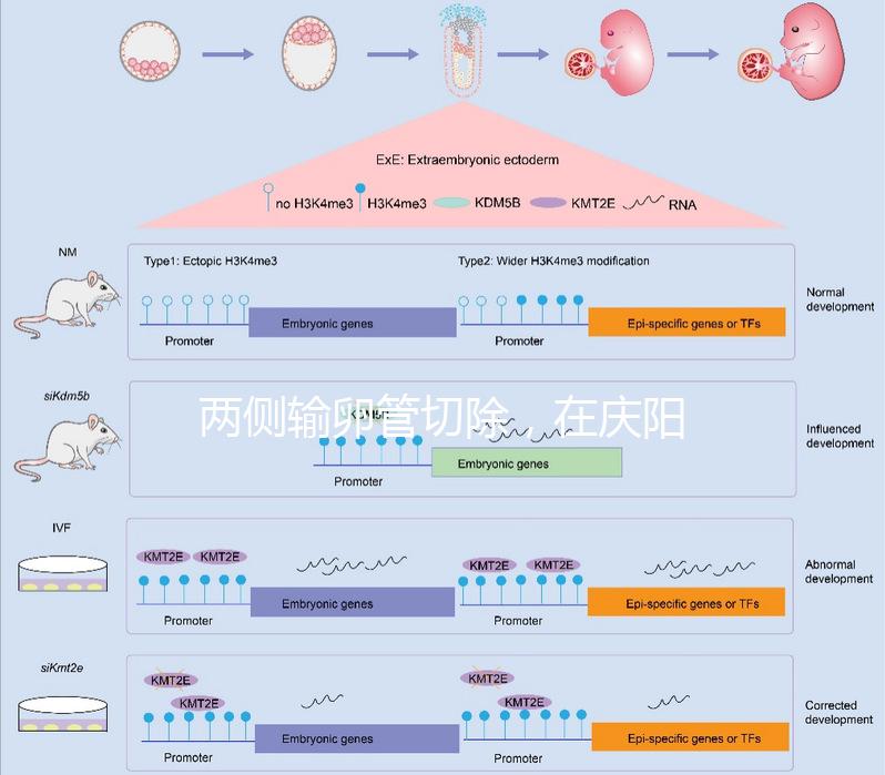 兩側輸卵管切除，在慶陽有醫(yī)院能做試管嬰兒嗎？