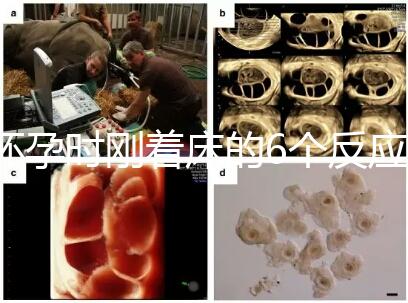 懷孕時剛著床的6個反應，同房后這個時候觀察身體最準