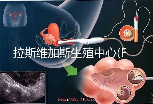 拉斯維加斯生殖中心(FCLV)：大齡女性赴美試管的選擇之一