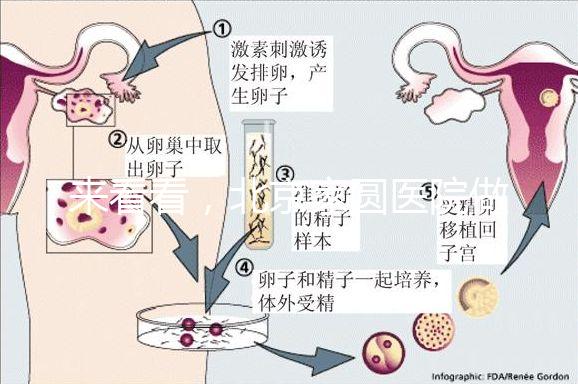 來看看,北京家圓醫院做三代試管費用總共多少?