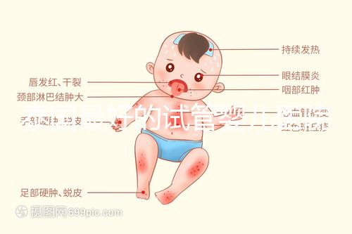 泰國(guó)最好的試管嬰兒醫(yī)院是哪家?公布最新前十名