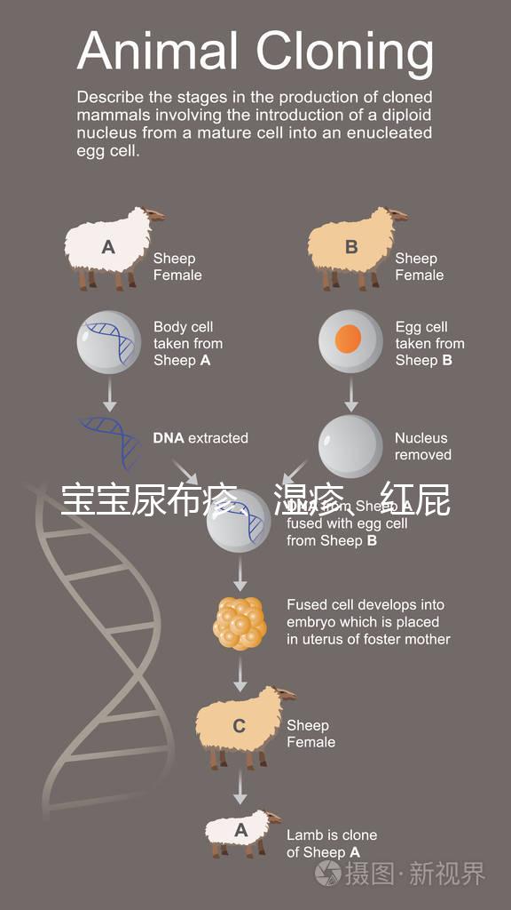 寶寶尿布疹、濕疹、紅屁股傻傻分不清？4點區別輕松診斷