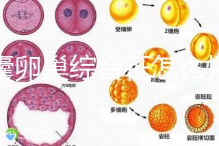 多囊卵巢綜合征怎么懷孕?試管嬰兒并不是唯一方案