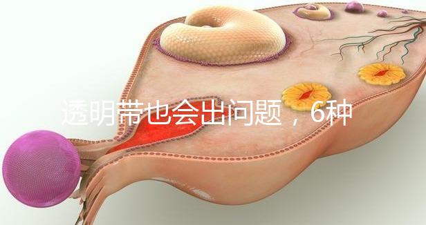 透明帶也會出問題，6種異常類型形成原因不同