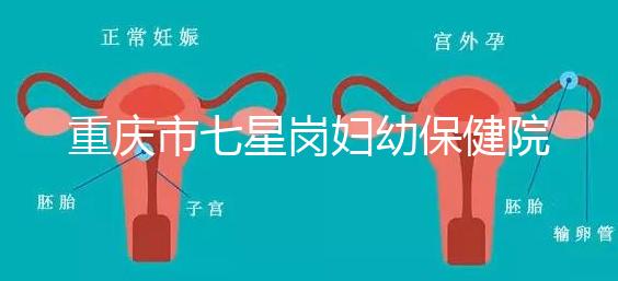 重慶市七星崗婦幼保健院做試管需要多少錢(qián)？可以用醫(yī)療保險(xiǎn)嗎？