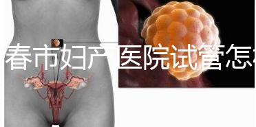 長春市婦產(chǎn)醫(yī)院試管怎樣問題解答，助孕成功率、費用可作參考