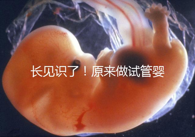 長見識了！原來做試管嬰兒，精子是這樣被篩選出來的
