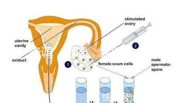 降調，進周，囊胚……這些試管嬰兒助孕術語你都懂嗎？