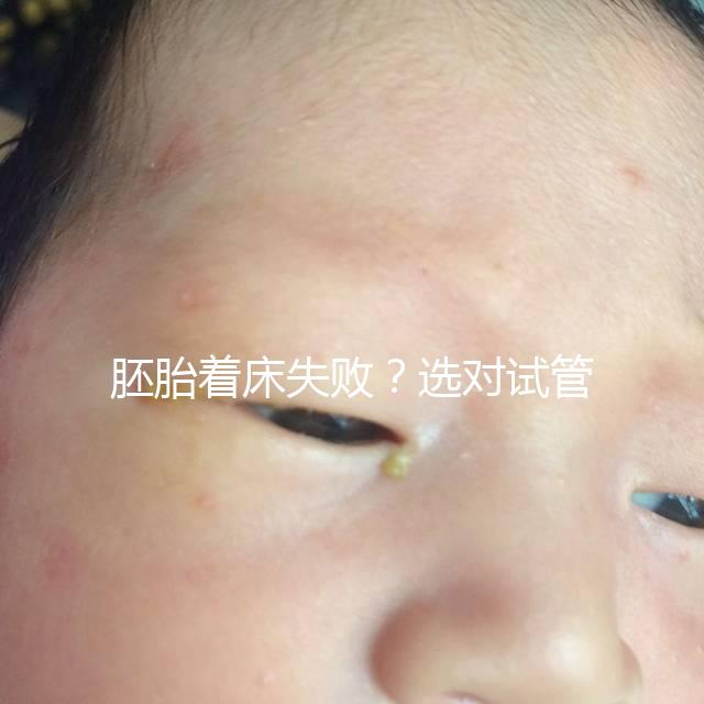 胚胎著床失??？選對試管嬰兒醫生很重要