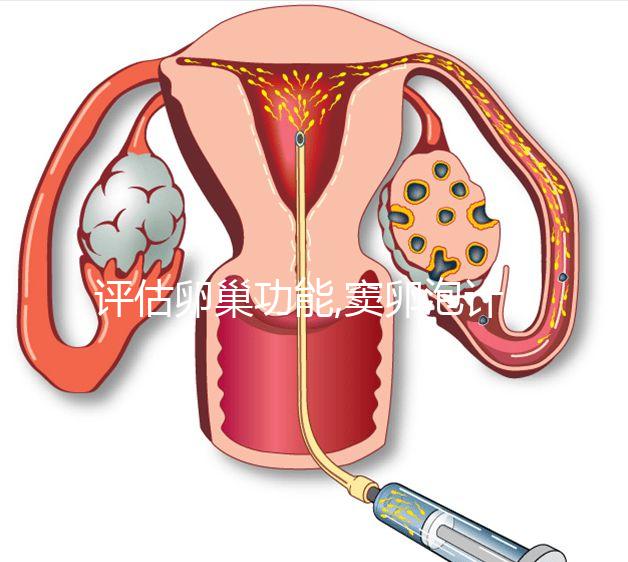 評(píng)估卵巢功能,竇卵泡計(jì)數(shù)最佳時(shí)間在月經(jīng)3