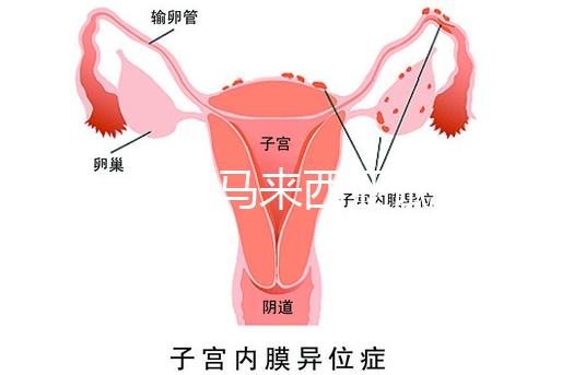還在糾結(jié)馬來(lái)西亞試管嬰兒醫(yī)院怎么選擇?讀完這篇文章,不困難