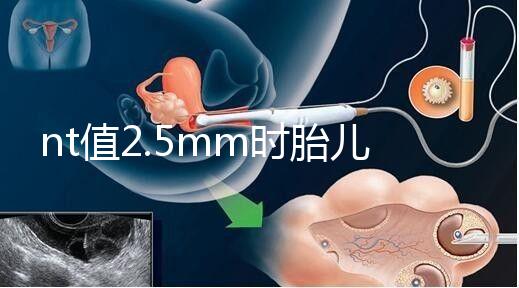 nt值2.5mm時胎兒異常幾率并不高，但羊水穿刺一定要做